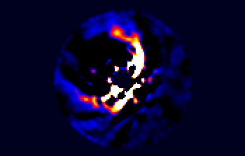 Early forming exoplanet system around the star HD 100546